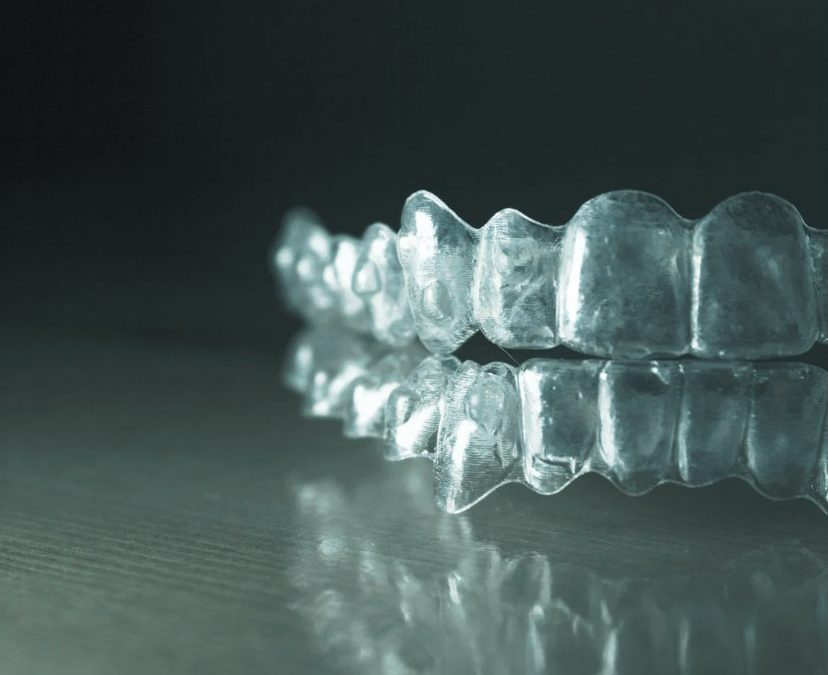 Orthodontie : un sourire aligné, une fonction retrouvée
